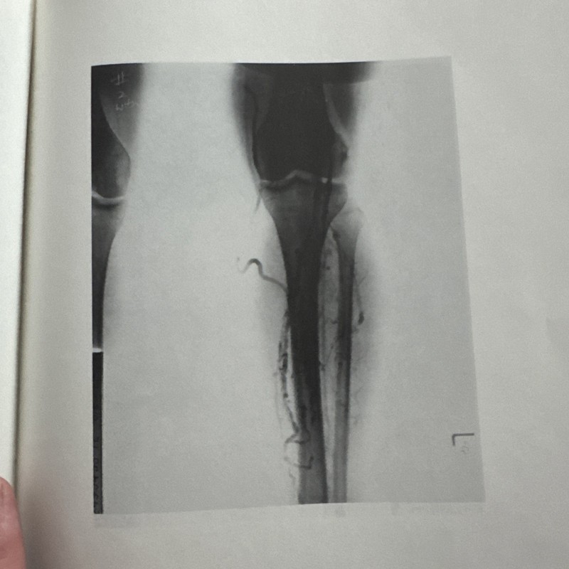 Trauma Medico Legal Volume 29 NO. 1, 2, 3, 4, 6 (5) 1988 gallery